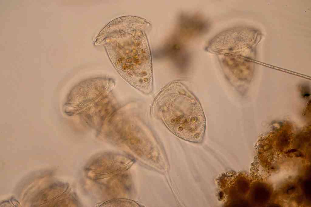 A microscopic view of a stalked ciliate organism